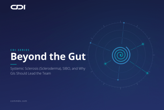 Beyond the Gut series graphic on systemic sclerosis and SIBO